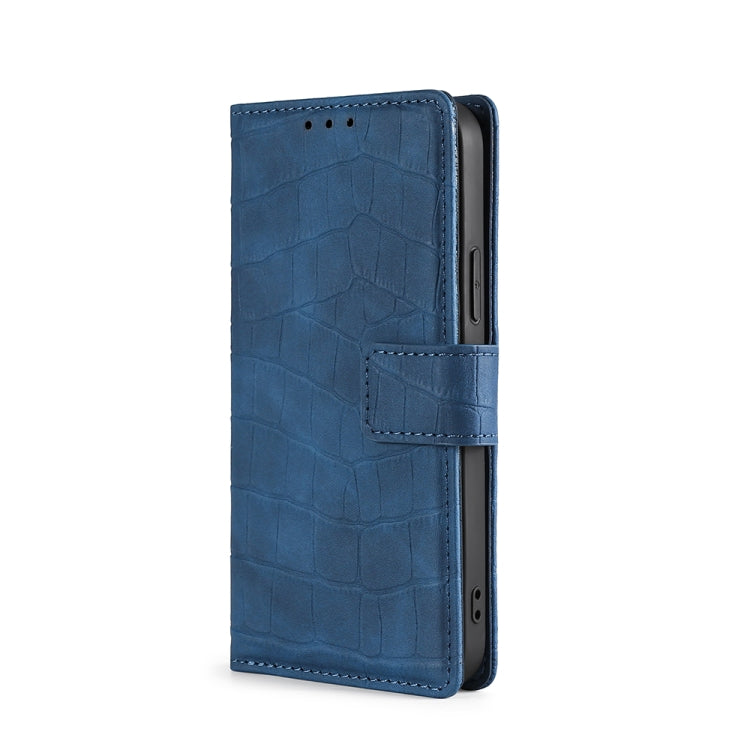 Funda de Cuero Huawei Nova 10 Skin Feel Cocodrilo Cierre Magnético (Azul)