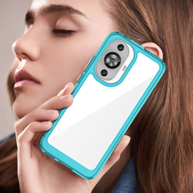 Funda Teléfono Acrílico + TPU Huawei Nova 12 Lite Serie Colorida (Azul Transparente)