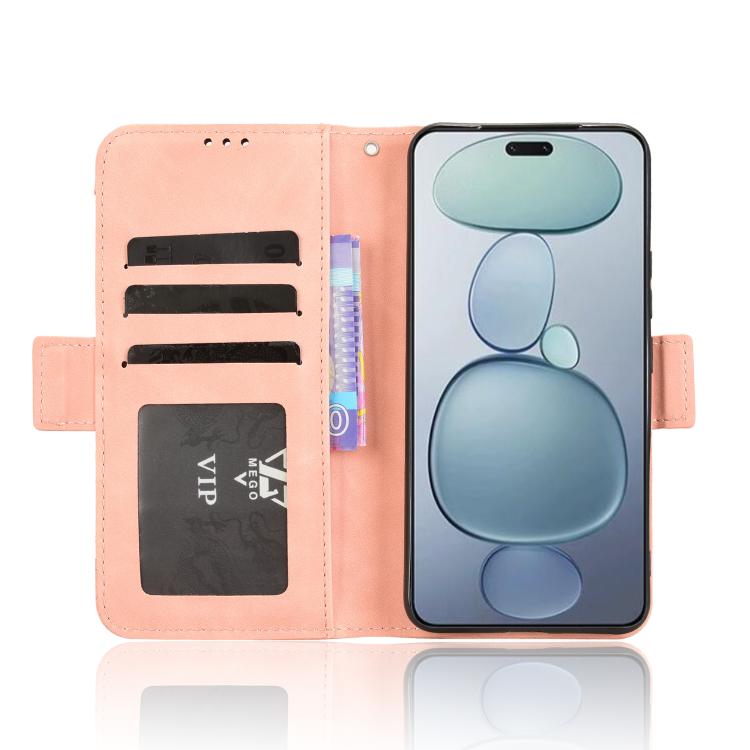 Funda de piel con textura de becerro y ranuras para tarjetas para Xiaomi Civi 5 Pro 5G (rosa)
