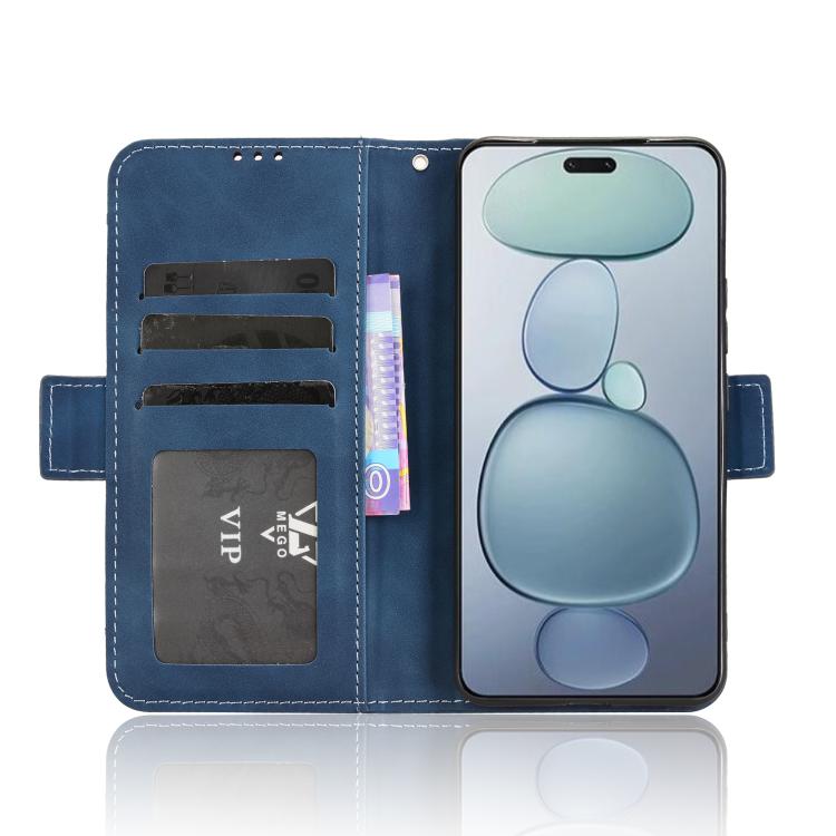 Funda de piel con textura de becerro y ranuras para tarjetas para Xiaomi Civi 5 Pro 5G (azul)